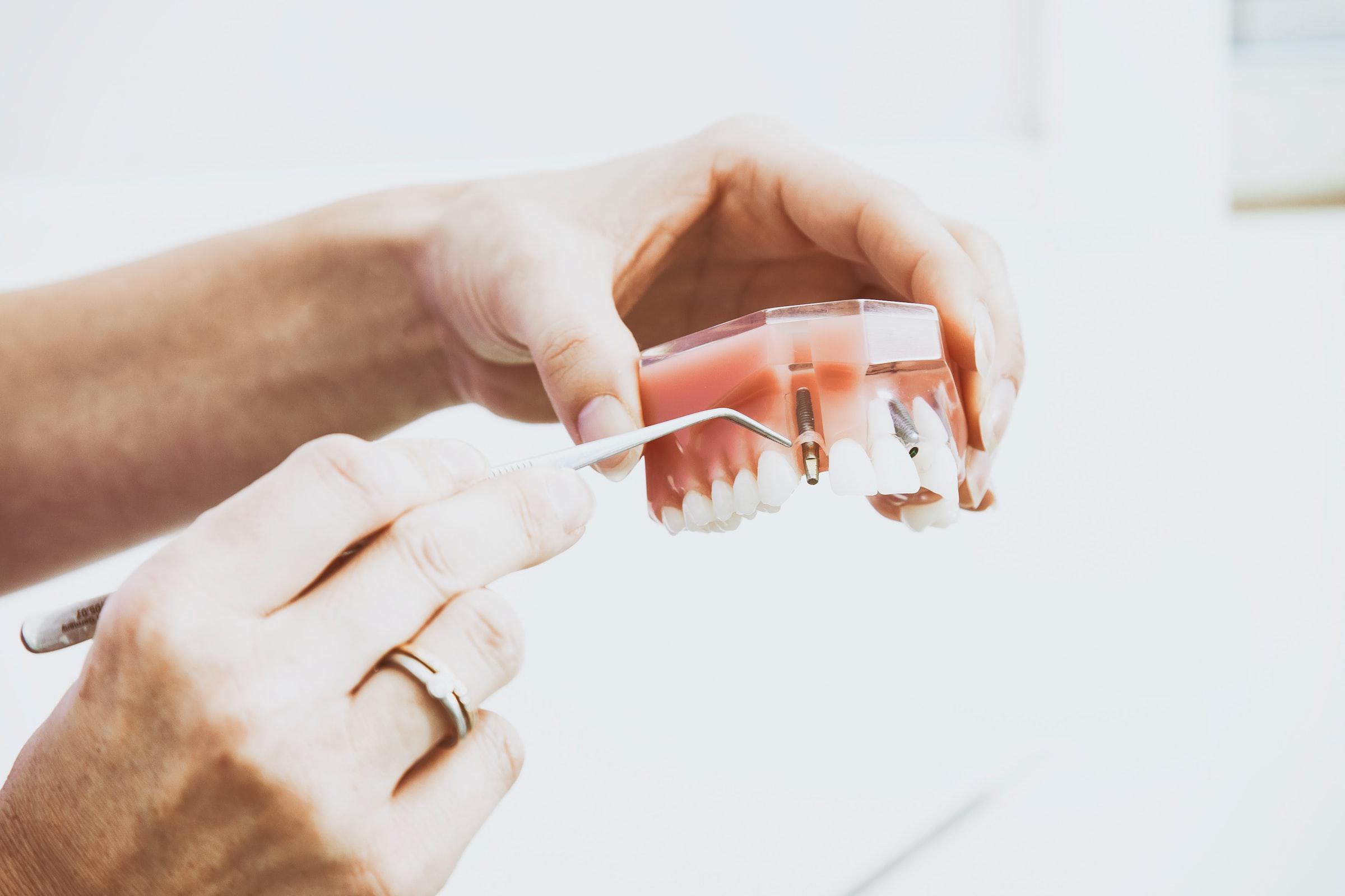 Two hands holding a model of dental implants in Huntington Beach