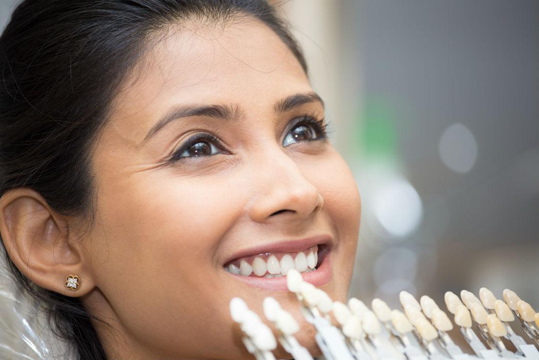 Dental Veneers: cosmetic dentist in Huntington Beach
