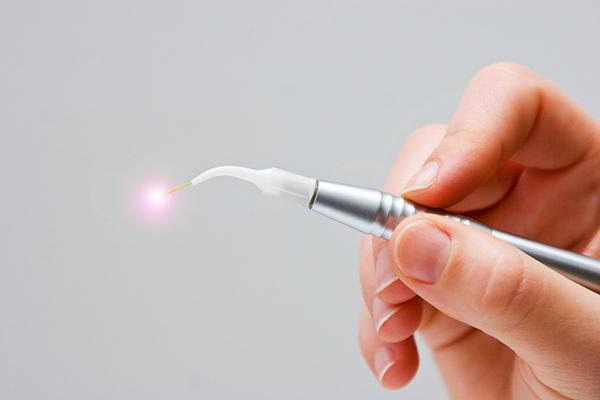 What is laser dentistry?