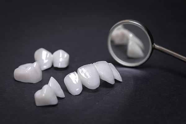 What are dental veneers? Huntington Beach Dentist