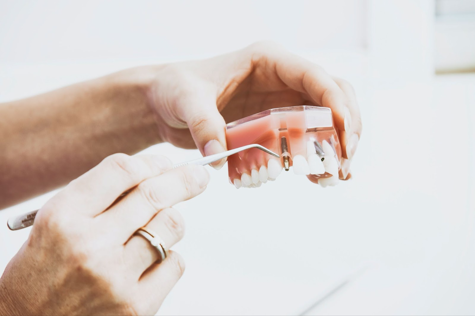 Our Huntington Beach Dentist Gives You Four Surprising Facts About Dental Implants