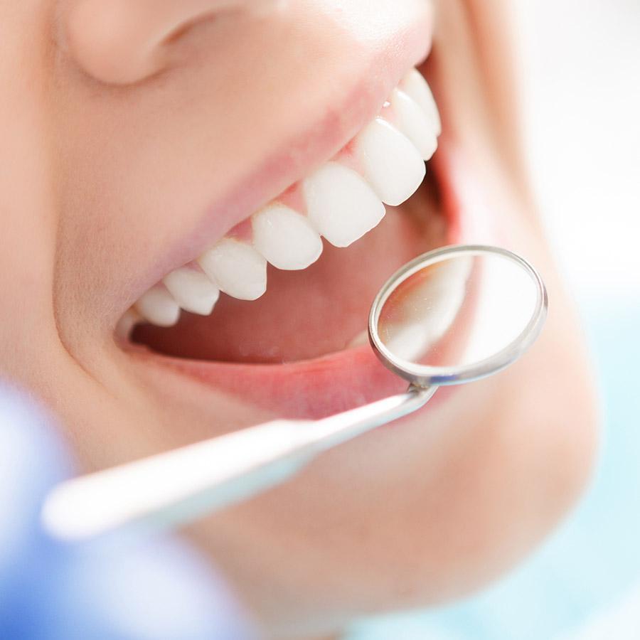 Teeth whitening service in Huntington Beach